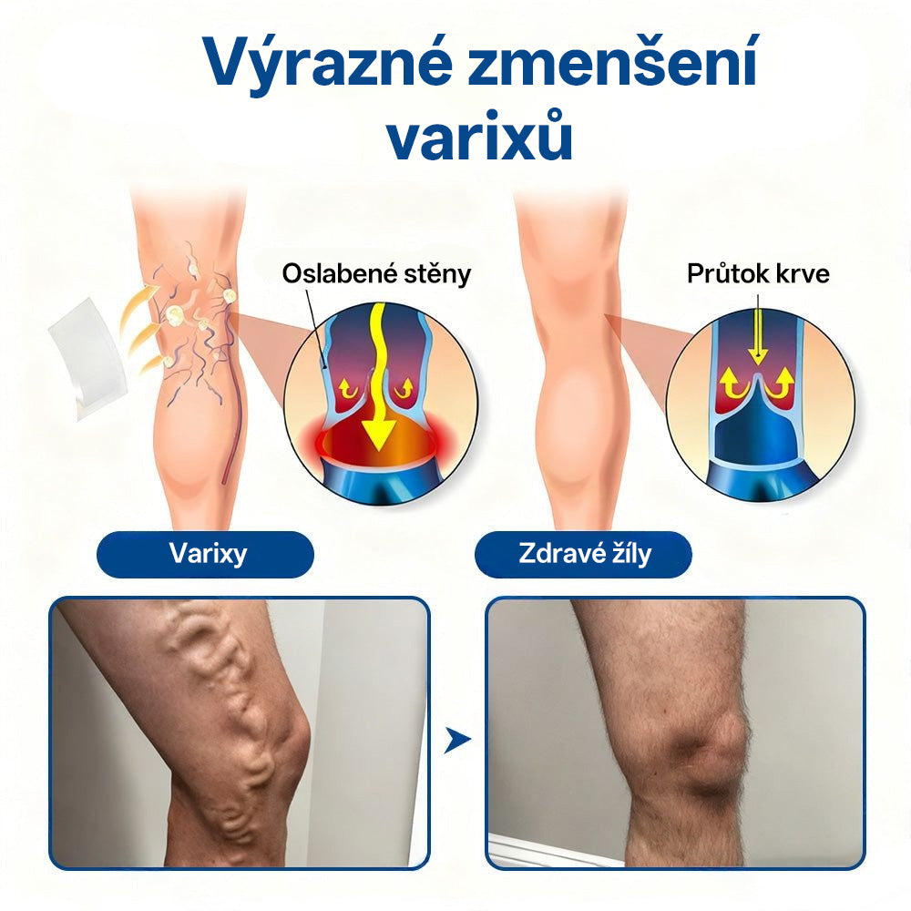 🇨🇿 💧✅GFOUK® VeinTarget Microneedle Patch |⚡ Okamžitá úleva, dlouhodobé výsledky🌱🛌
