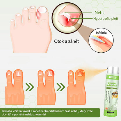 ✅Foulme® NailRescue Včelí jed ve spreji🐝