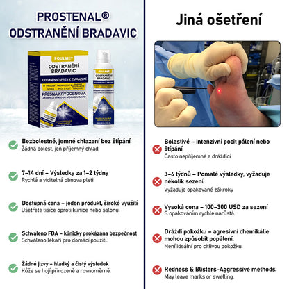 🎄🎄Foulme® WartErase Kryogenní sprej🎅✨