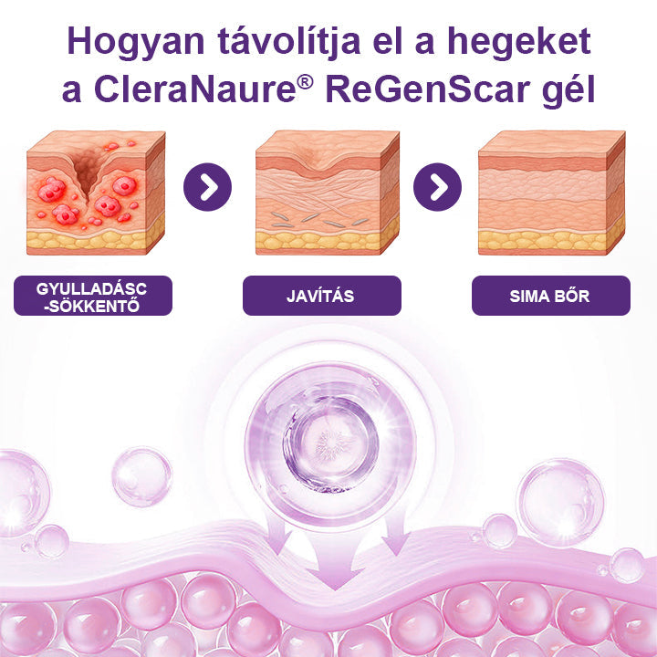 CleraNaure® ReGenScar Őssejt Hegeket Helyreállító Gél