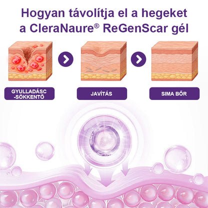 CleraNaure® ReGenScar Őssejt Hegeket Helyreállító Gél