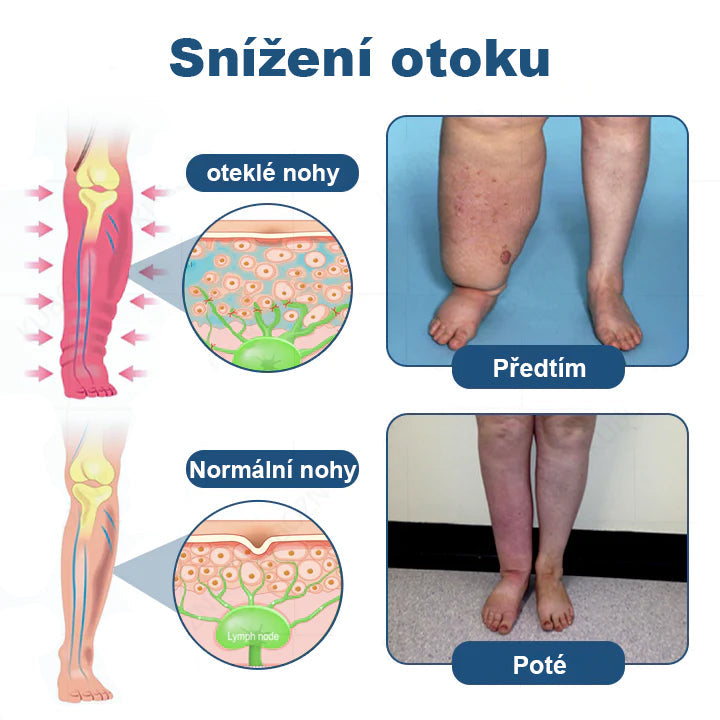 CleraNaure® Roll-on krém pro lymfatickou drenáž a úlevu od otoků✨