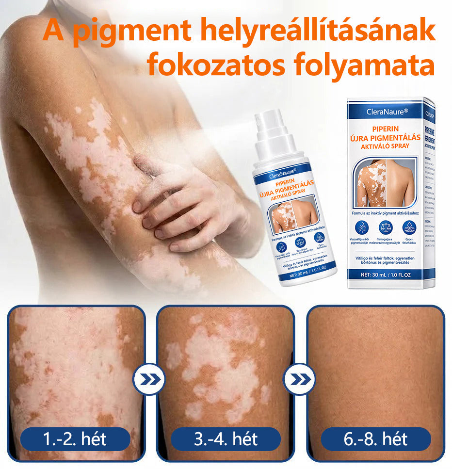 CleraNaure® Piperine Repigment Aktivátor Spray, amely aktiválja a lappangó pigmentsejteket, és visszaállítja a természetes bőrszínt.