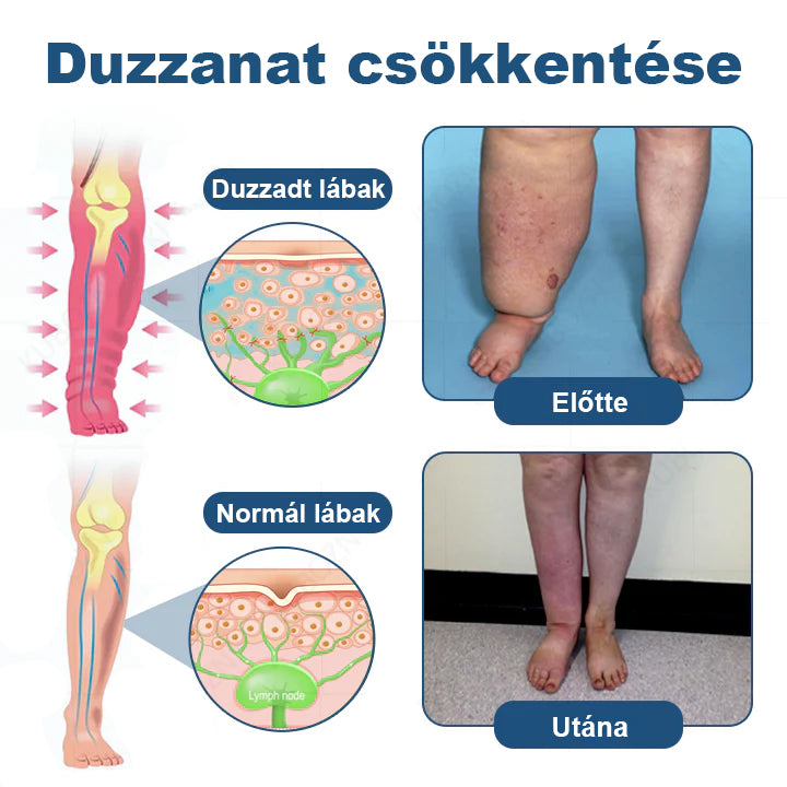 CleraNature® Roll-On Pump Krém a Nyirokdrainázáshoz és Duzzanat Enyhítéséhez