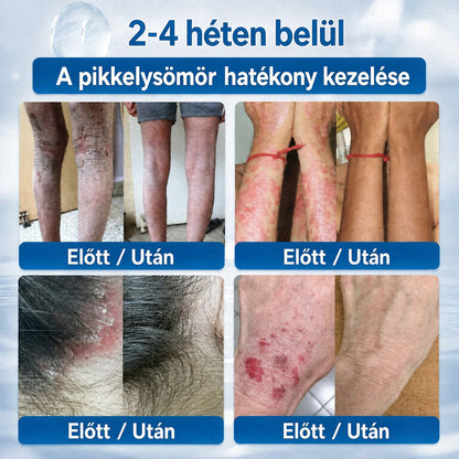 CleraNaure® Bőr Egyenetlenség Finomító Krém｜Segít a zavaró bőrkiemelkedések, anyajegyek és pigmentfoltok kezelésében, kíméletes otthoni bőrápoló krém🌿