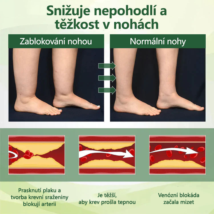Řekněte sbohem oteklým, bolestivým nohám – CleraNaure® FluidEase Profesionální krém pro prokrvení nohou přináší skutečnou úlevu!