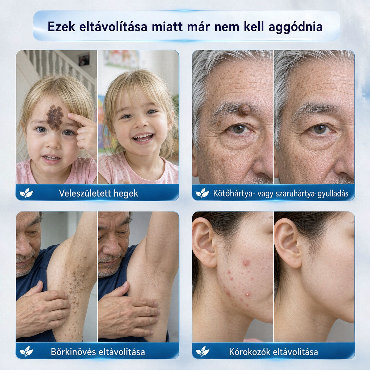 CleraNaure® Bőr Egyenetlenség Finomító Krém｜Segít a zavaró bőrkiemelkedések, anyajegyek és pigmentfoltok kezelésében, kíméletes otthoni bőrápoló krém🌿