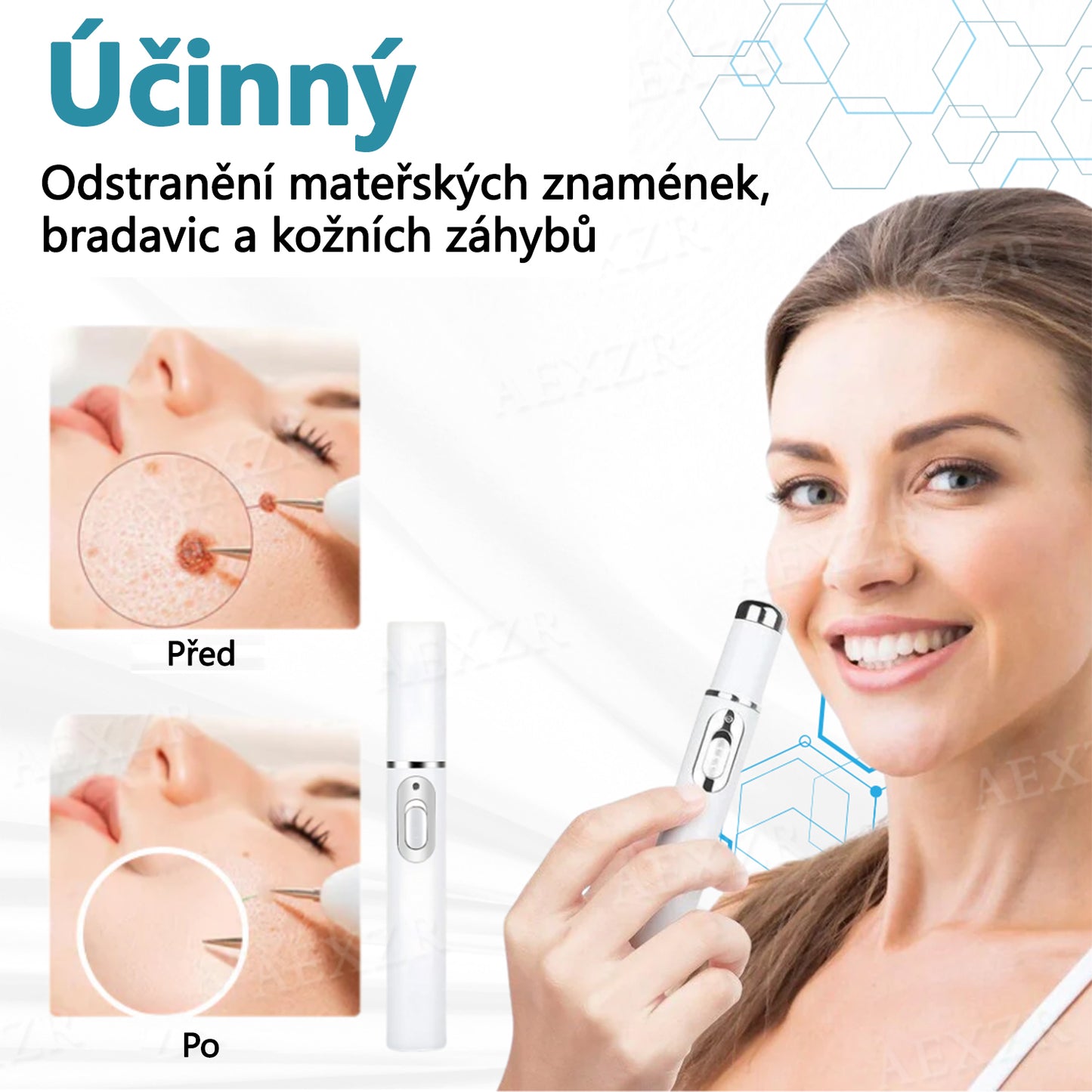 💥💥Foulme® PRO Neinvazivní laserové pero na odstraňování bradavic a znamének💥💥