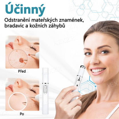 💥💥Foulme® PRO Neinvazivní laserové pero na odstraňování bradavic a znamének💥💥