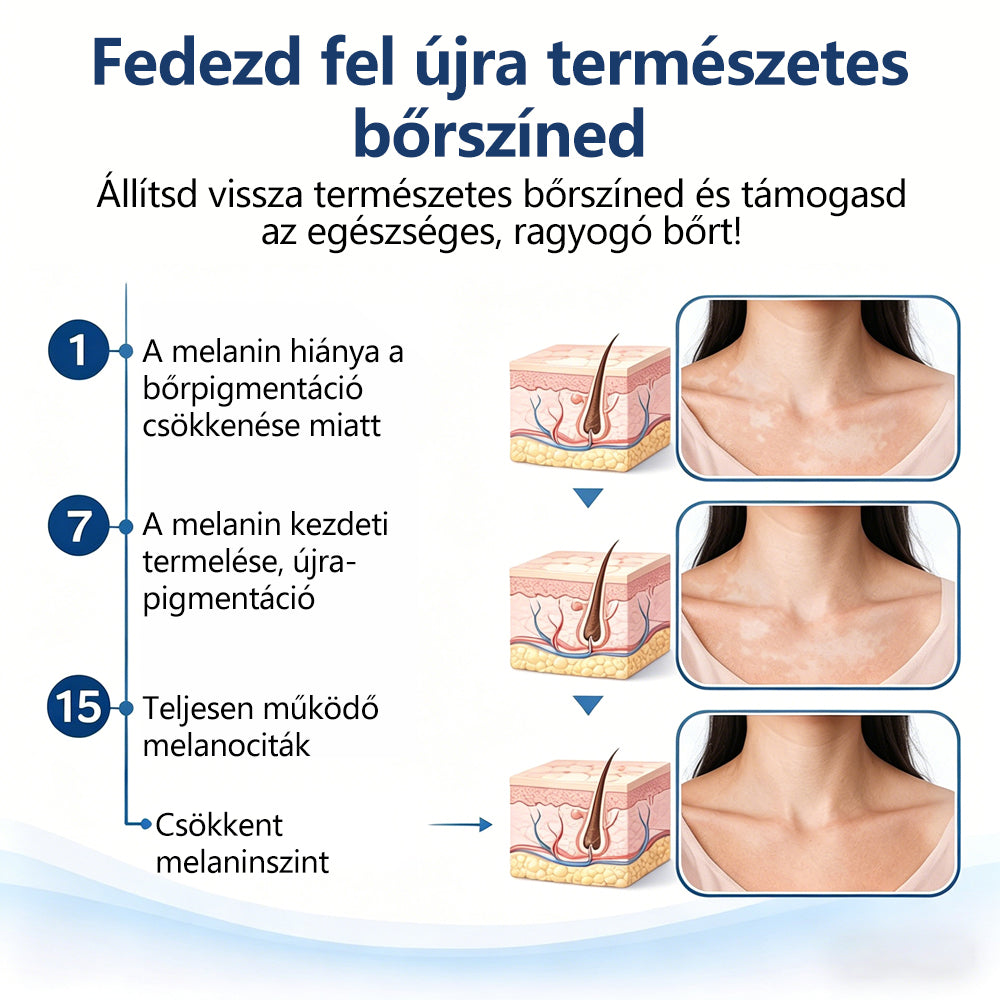 CleraNaure® Piperin Vitiligo újrapigmentáló permet – 🌿Szteroidmentes növényi összetétel | Kíméletes és hatékony minden bőrtípushoz✨