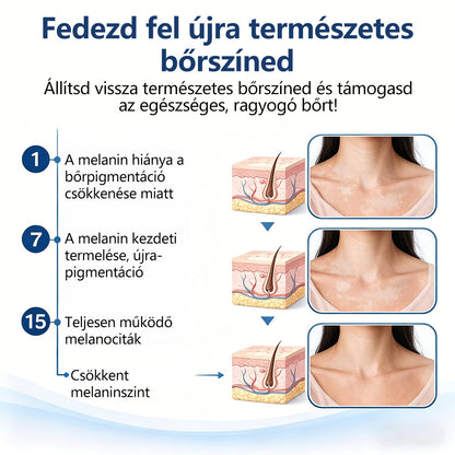 CleraNaure® Piperin Vitiligo újrapigmentáló permet – 🌿Szteroidmentes növényi összetétel | Kíméletes és hatékony minden bőrtípushoz✨