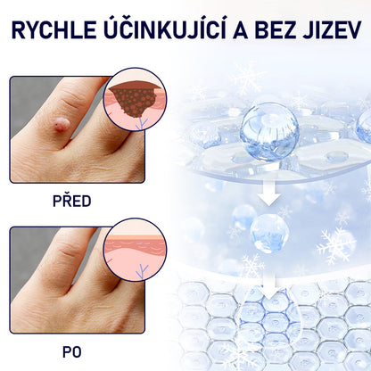 Foulme® WartErase Kryogenní sprej