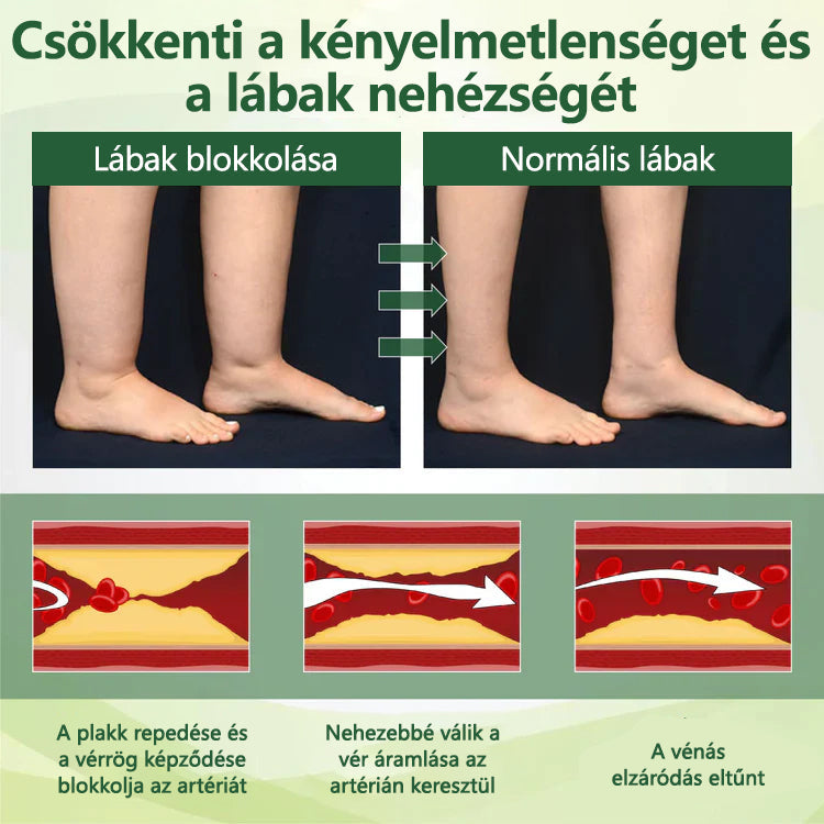 CleraNaure® FluidEase Professzionális krém—Mondj búcsút a lábdagadásnak és -fájdalomnak