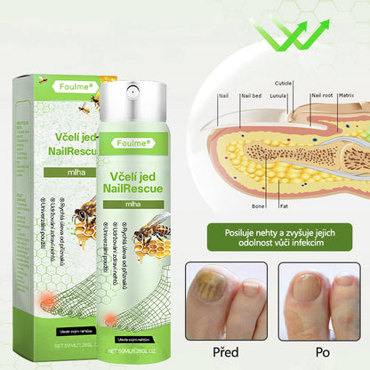 ✅Foulme® NailRescue Včelí jed ve spreji🐝