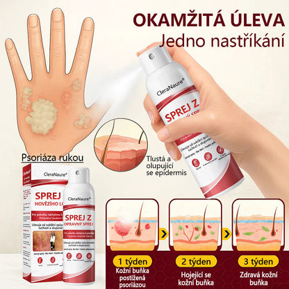 CleraNature® Sprej s Hovězím Tvarohem pro Svědící, Olupující se Pokožku Při Psoriáze