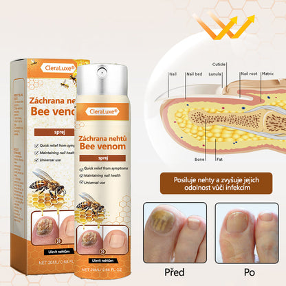 ✅✅【Oficiální vlajkový obchod】CleraLuxe® NailRescue Včelí jed ve spreji