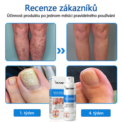 ✅COLTURE® Magnesium bylinný sprej ⚕️ Certifikace MHRA – úleva při psoriáze, ekzému, intimních bakteriálních infekcích, akné a tmavých skvrnách