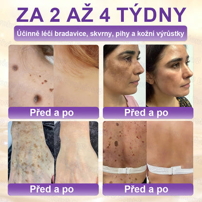 ✅Vyrobeno a dodáno z České republiky ✨⚡ FOULME® Biotin 10-v-1 krém na obnovu pokožky