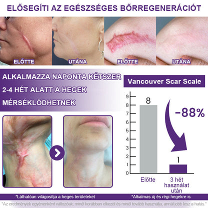CleraNaure® ReGenScar Őssejt Hegeket Helyreállító Gél