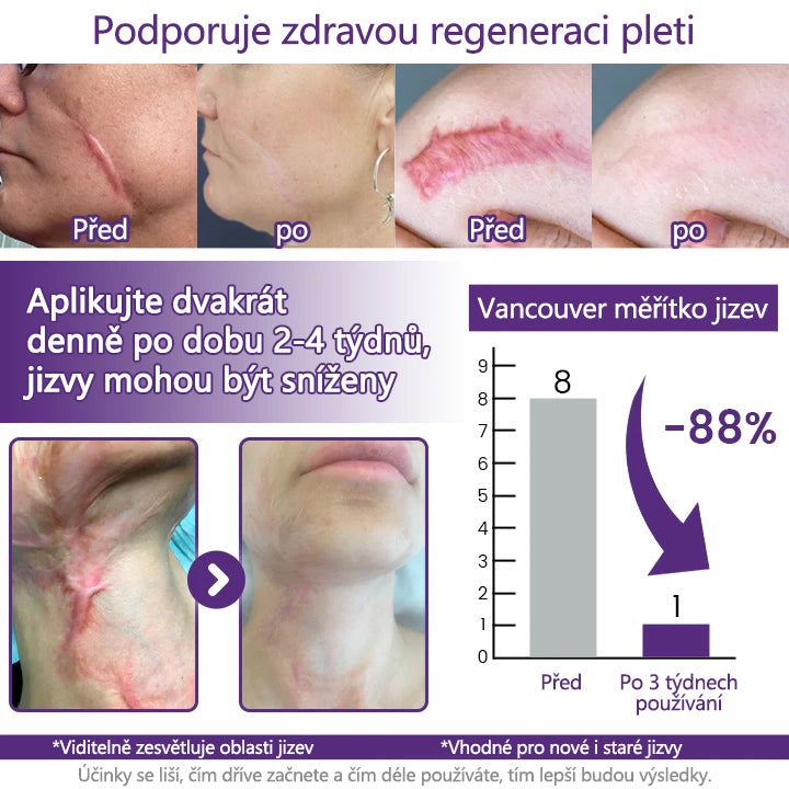 FOULME® ReGenScar – Regenerační gel na jizvy s kmenovými buňkami
