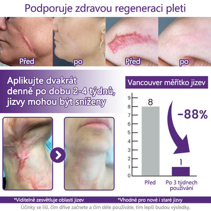 FOULME® ReGenScar – Regenerační gel na jizvy s kmenovými buňkami
