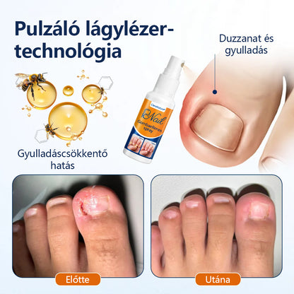 CleraNaure® körömgomba‑könnyítő spray