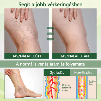CleraNaure® FluidEase Professzionális krém—Mondj búcsút a lábdagadásnak és -fájdalomnak