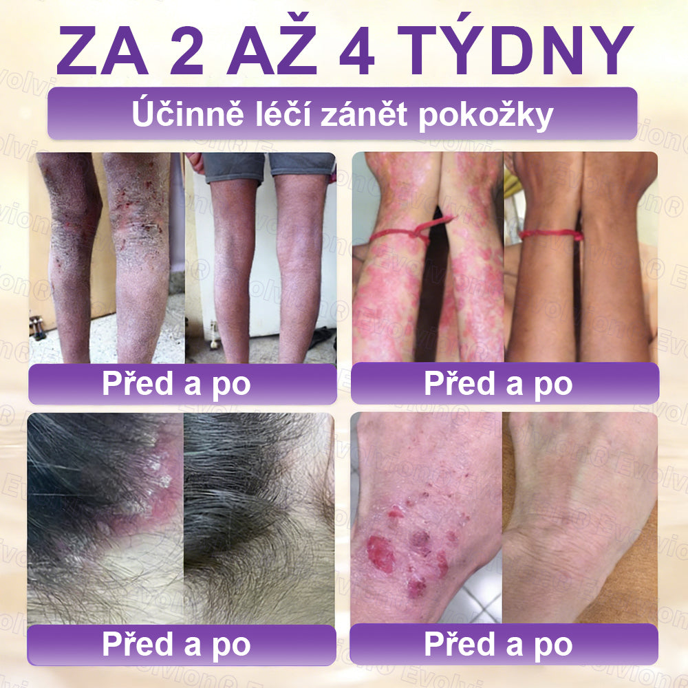 ✅Vyrobeno a dodáno z České republiky ✨⚡ FOULME® Biotin 10-v-1 krém na obnovu pokožky