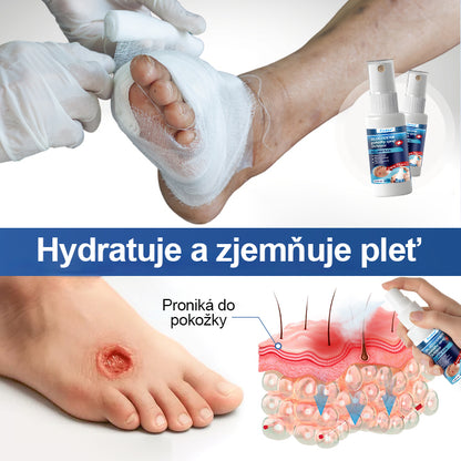 Foulme® GlucoDerm bariérový sprej ✨✨