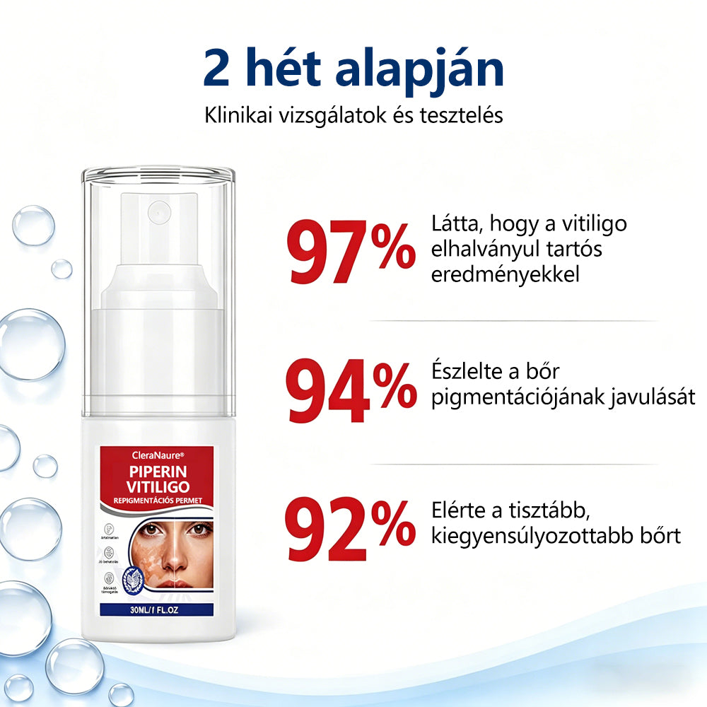 CleraNaure® Piperin Vitiligo újrapigmentáló permet – 🌿Szteroidmentes növényi összetétel | Kíméletes és hatékony minden bőrtípushoz✨