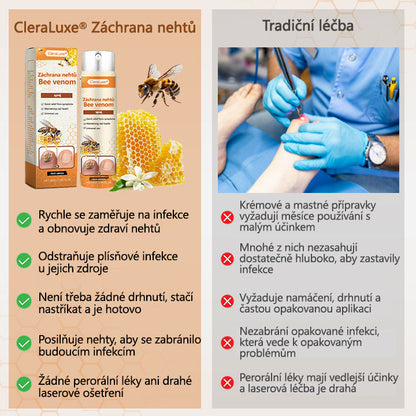 ✅✅【Oficiální vlajkový obchod】CleraLuxe® NailRescue Včelí jed ve spreji