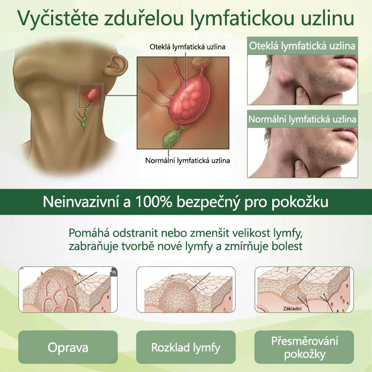 Řekněte sbohem oteklým, bolestivým nohám – CleraNaure® FluidEase Profesionální krém pro prokrvení nohou přináší skutečnou úlevu!