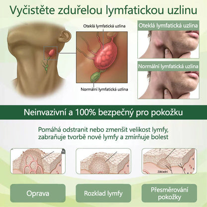 Řekněte sbohem oteklým, bolestivým nohám – CleraNaure® FluidEase Profesionální krém pro prokrvení nohou přináší skutečnou úlevu!
