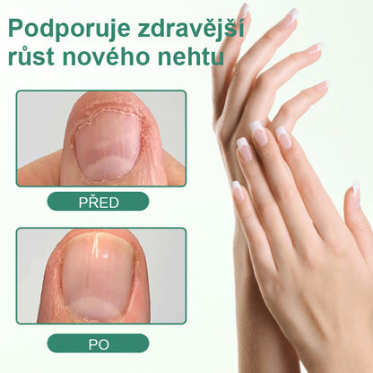 CleraNaure® Nail Detox – penetrační sérové pero na nehty