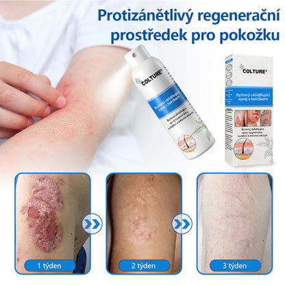 ✅COLTURE® Magnesium bylinný sprej ⚕️ Certifikace MHRA – úleva při psoriáze, ekzému, intimních bakteriálních infekcích, akné a tmavých skvrnách