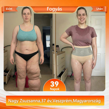 Hivatalos márkabolt | CleraNaure® 2026 Moringa és Berberin 4 az 1-ben mikrorészecskés alakformáló és zsírégető rövidnadrág