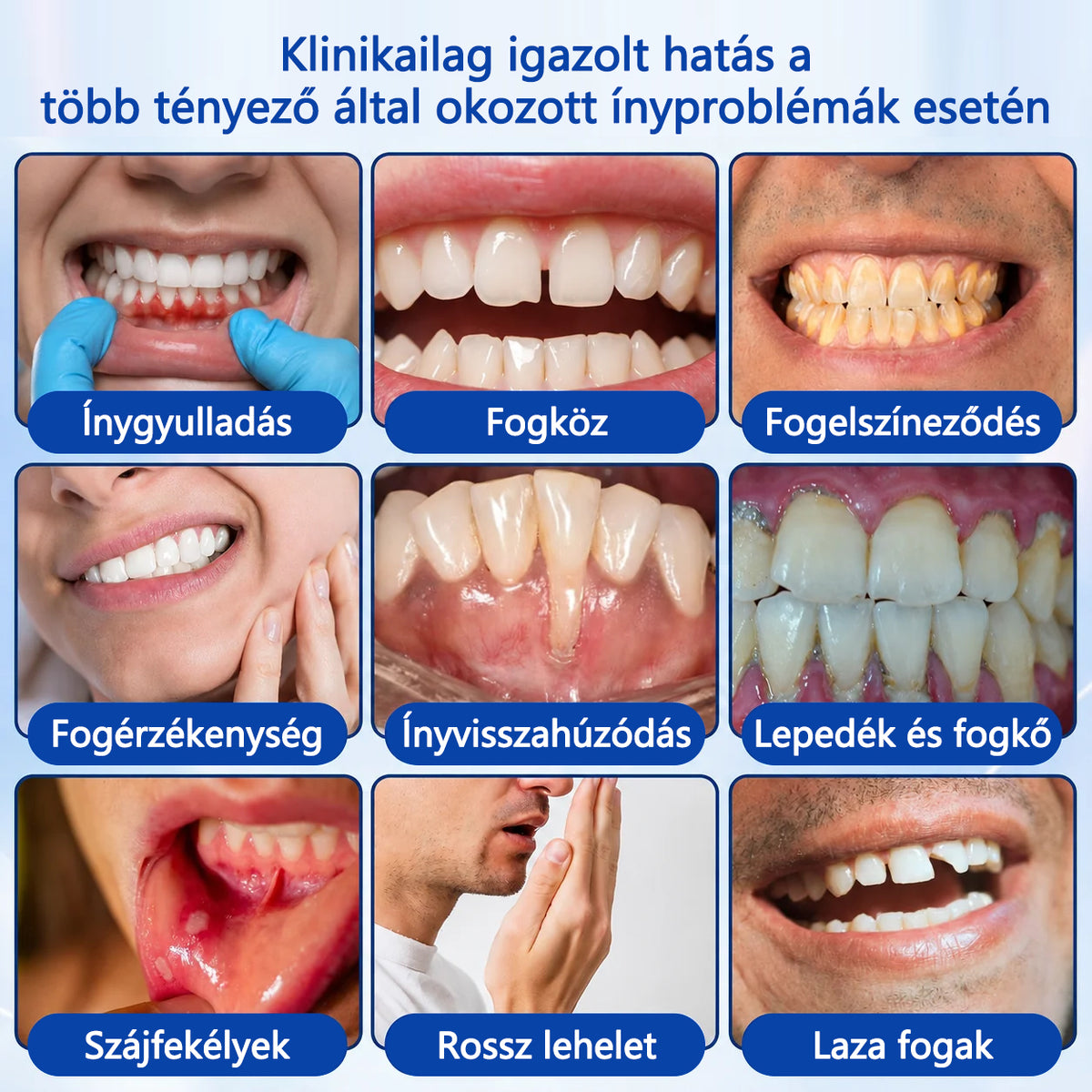 CleraNaure® GumRevive fogágy-szövetregeneráló gél