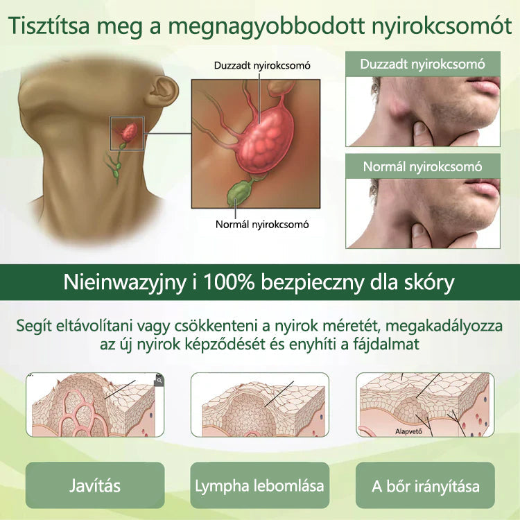 CleraNaure® FluidEase Professzionális krém—Mondj búcsút a lábdagadásnak és -fájdalomnak