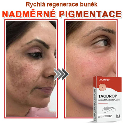 COLTURE® Mikrovpichová botanická náplast na odstranění kožních výrůstků