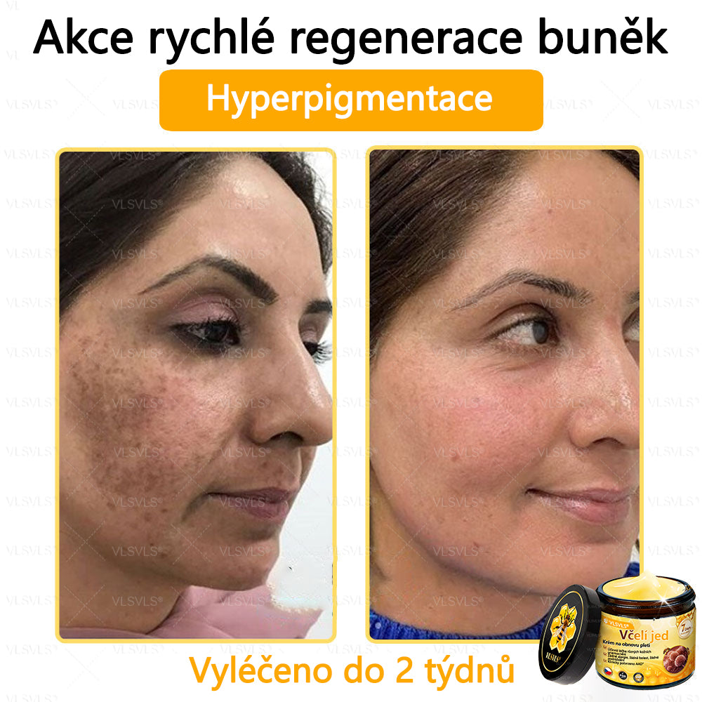 ✅VLSVLS™ Obnovující krém se včelím jedem🐝💥