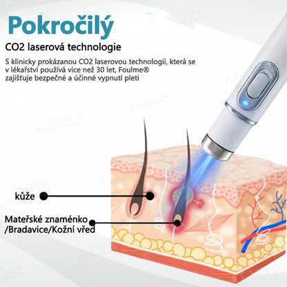 💥💥Foulme® PRO Neinvazivní laserové pero na odstraňování bradavic a znamének💥💥