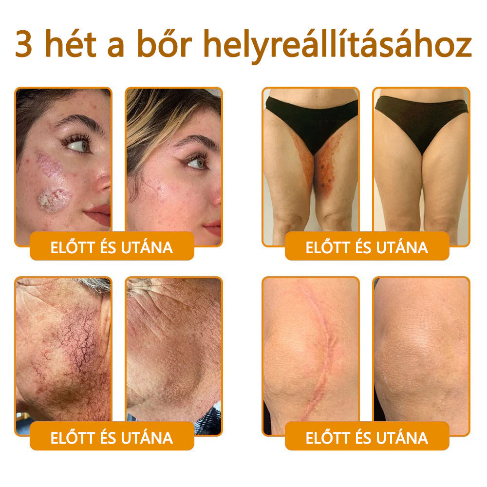 CleraNaure® Méhméreg Bőrregeneráló Krém