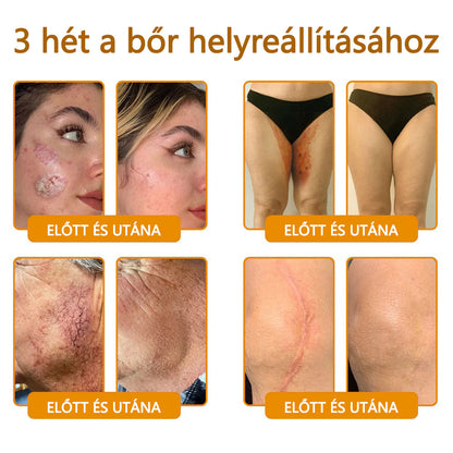 CleraNaure® Méhméreg Bőrregeneráló Krém