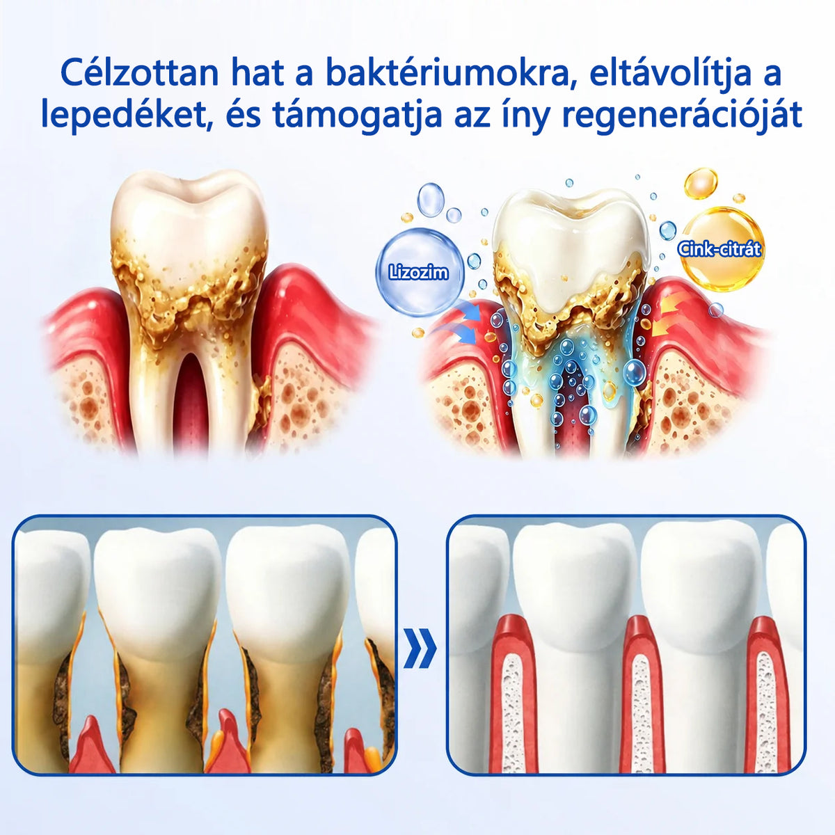 CleraNaure® GumRevive fogágy-szövetregeneráló gél