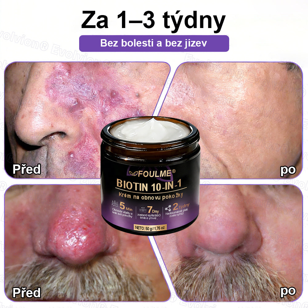✅Vyrobeno a dodáno z České republiky ✨⚡ FOULME® Biotin 10-v-1 krém na obnovu pokožky