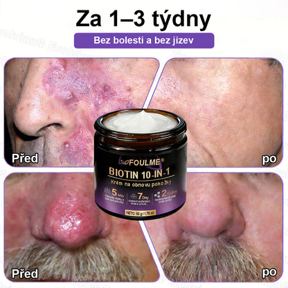 ✅Vyrobeno a dodáno z České republiky ✨⚡ FOULME® Biotin 10-v-1 krém na obnovu pokožky