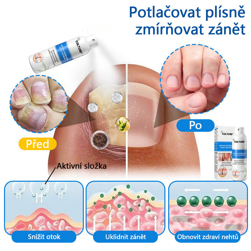 ✅COLTURE® Magnesium bylinný sprej ⚕️ Certifikace MHRA – úleva při psoriáze, ekzému, intimních bakteriálních infekcích, akné a tmavých skvrnách