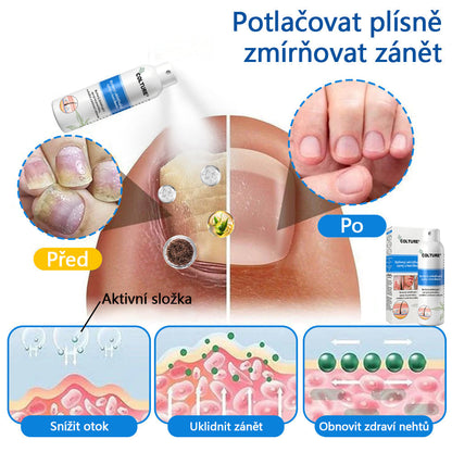✅COLTURE® Magnesium bylinný sprej ⚕️ Certifikace MHRA – úleva při psoriáze, ekzému, intimních bakteriálních infekcích, akné a tmavých skvrnách
