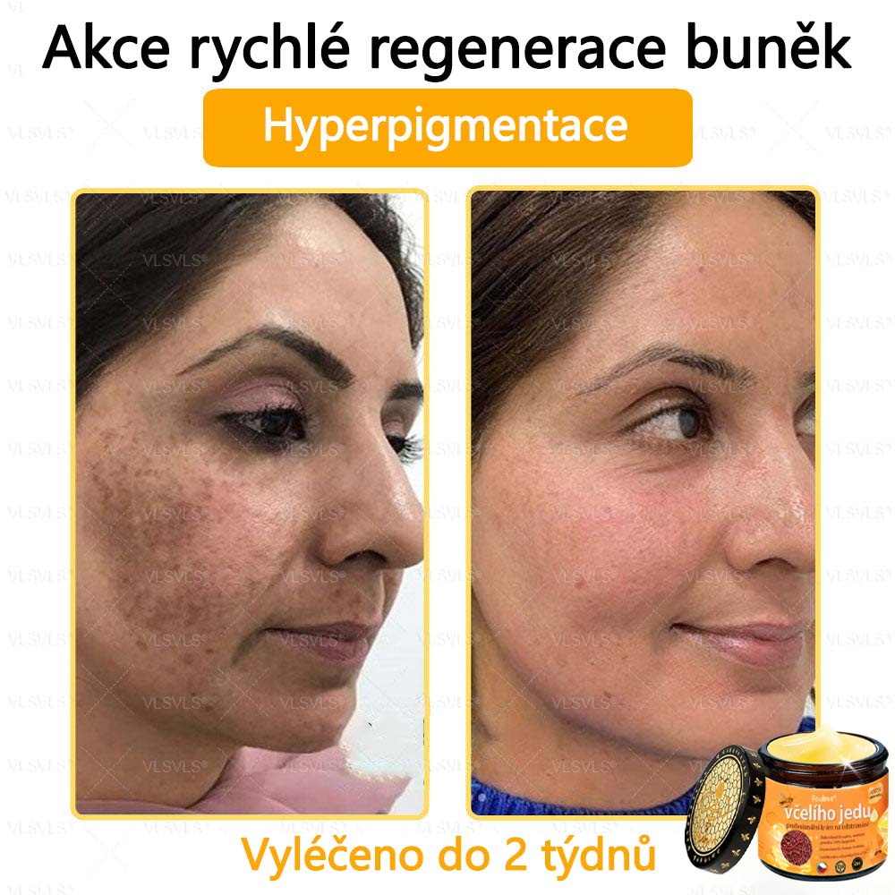 ✅Foulme® Obnovující krém se včelím jedem🐝