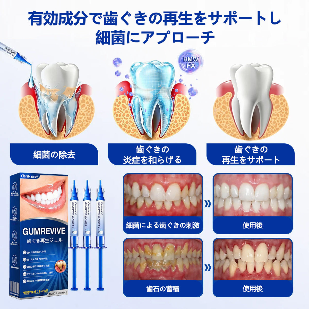 CleraNaure® GumRevive fogágy-szövetregeneráló gél